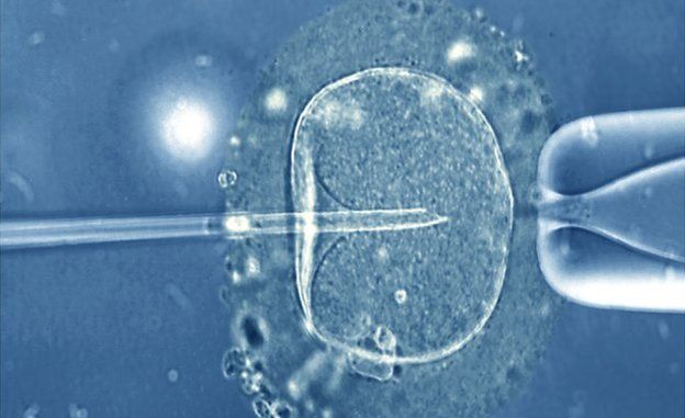 _84403666_m8020233-in_vitro_fertilization_light_microscope-spl