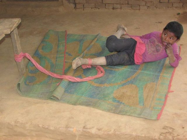 उपचार नपाउँदा सात वर्षदेखि डोरीमा बाँधिन बाध्य बालक