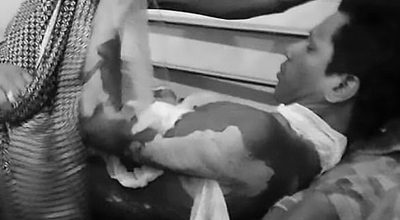 मोवाइलको पासवर्ड विवादमा श्रीमतीले पेट्रोल छर्केर श्रीमानलाई जिउँदै जलाएपछि …