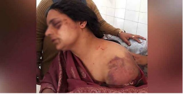 सैनिकले श्रीमतीलाई कुटेर यस्तो हालत बनाएपछि…