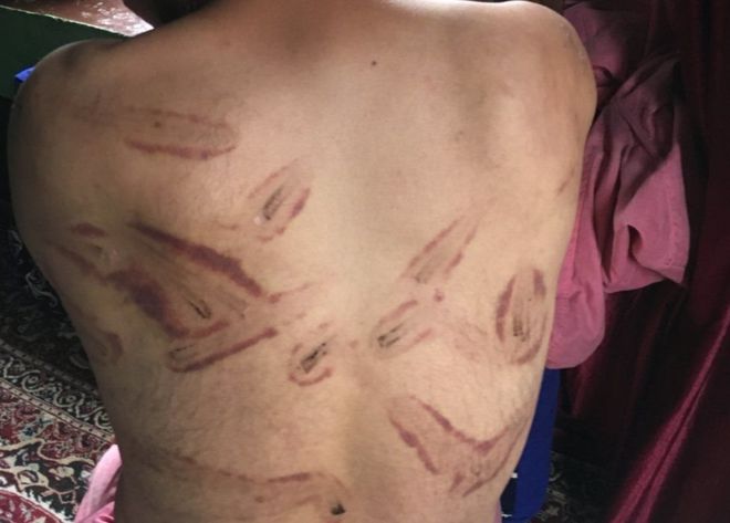 भारतीय सेनाले यातना दिएको कश्मीरी गाउँलेको आरोप