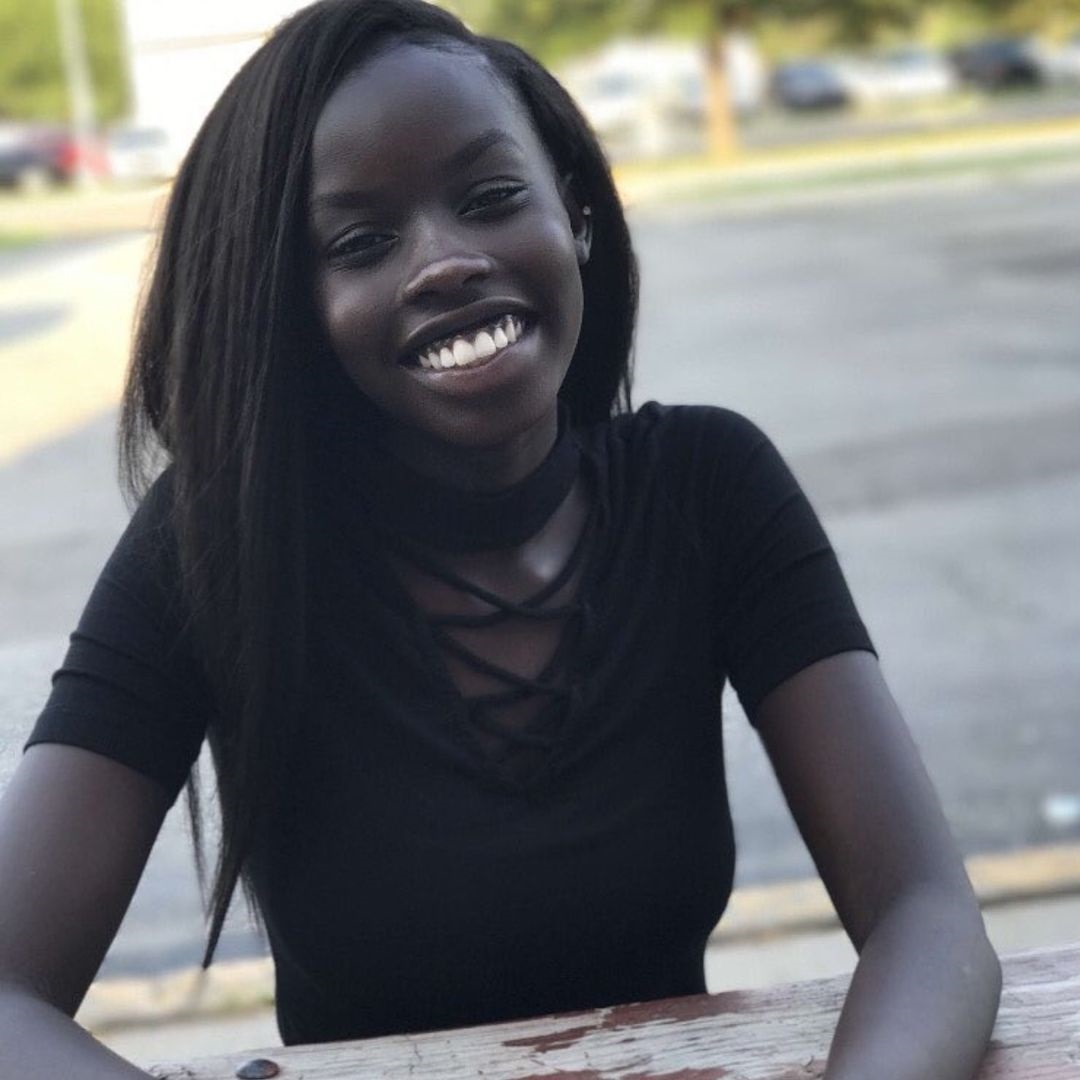 कालो वर्ण हुनुको फाइदा