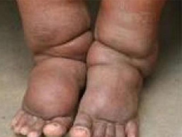 बागलुङमा निवारण भएन हात्तीपाइले