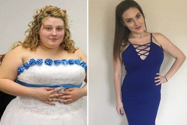 १४६ किलोकी महिलाले घटाइन् ८८ किलो तौल